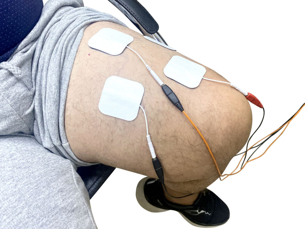 Laserterapia - Fotobiomodelação - Tratamento com laser - Fisioterapia em São Paulo - Fisioterapia em Guarulhos - Clínica de Fisioterapia - Thamyres Gattolin - Dra Thamyres Gattolin