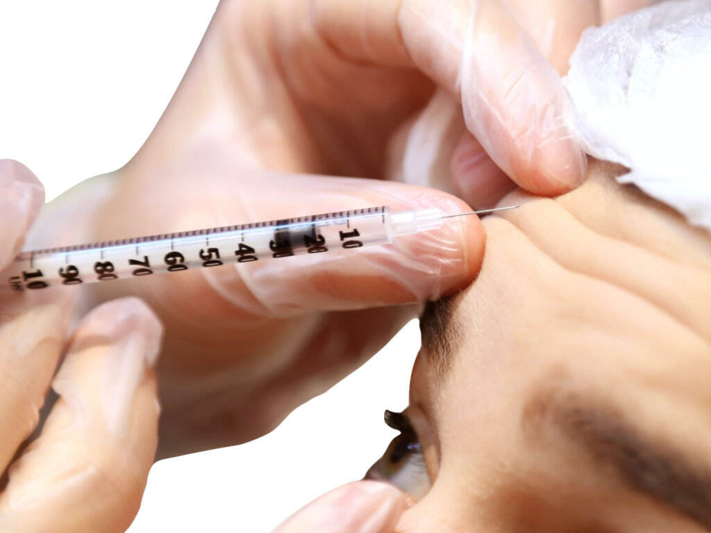 Toxina Botulínica - Botox - Dra Thamyres Gattolin